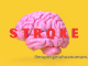pengertian stroke dan gejala stroke serta cara mencegah stroke